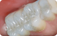 tooth