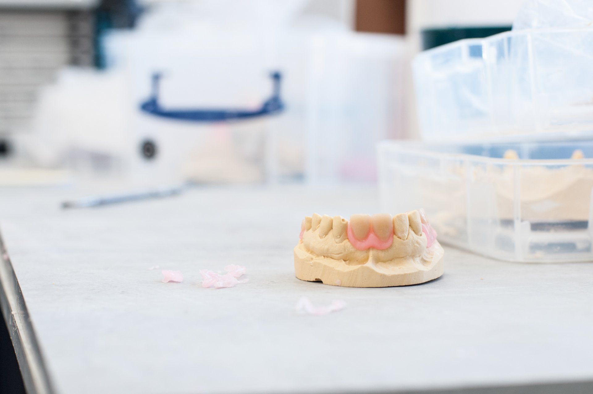 lab work molds