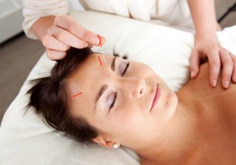 acupuncture treatment