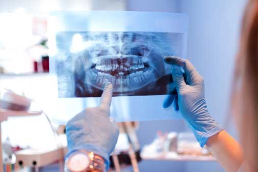 Teeth X-ray — St. Clair Shores, MI — Richard G. Raad, DDS, PC