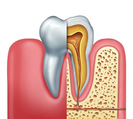 Endodontics — St. Clair Shores, MI — Richard G. Raad, DDS, PC