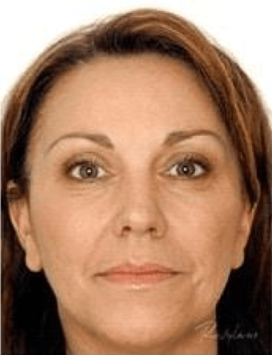 Close-up portrait of a person with short brown hair against a white background, neutral expression.