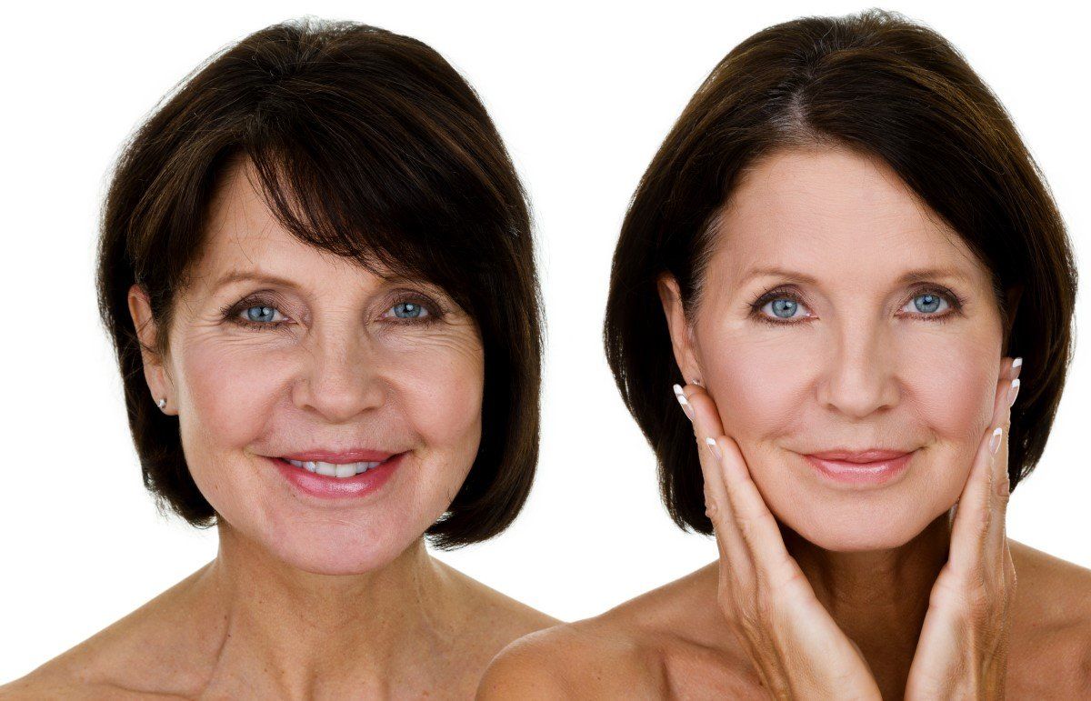 Two side-by-side portraits of a smiling woman, one natural and one with smoother skin and makeup