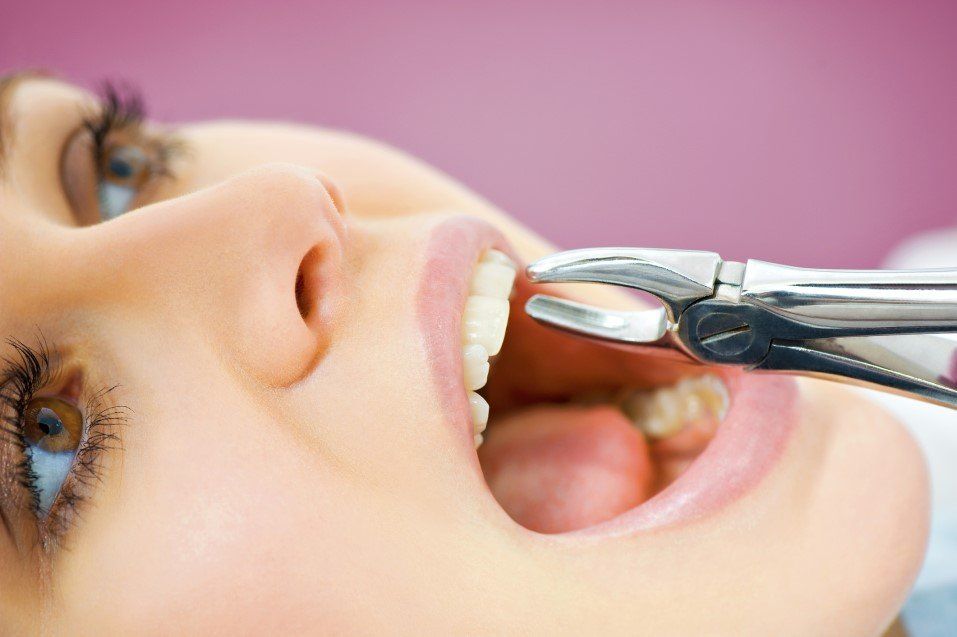 Dental tool near open mouth during teeth examination