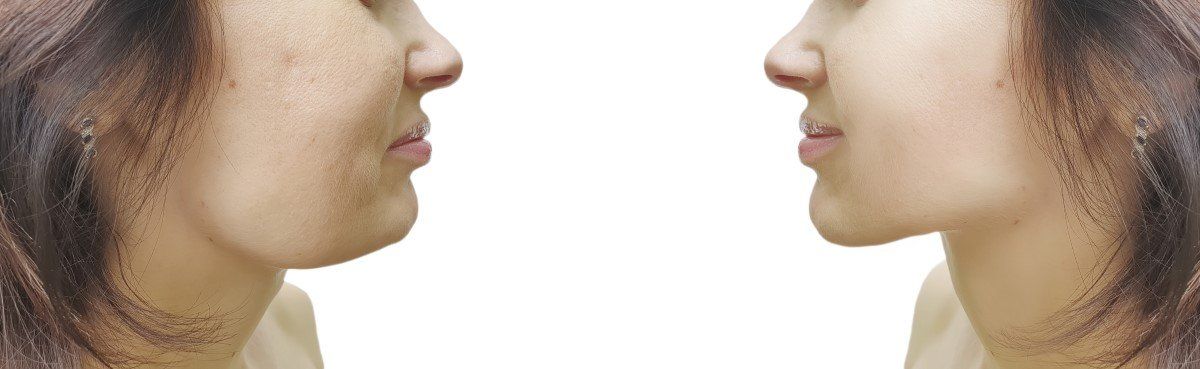 Two women in profile facing each other on a white background, one with curly hair and one with straight hair