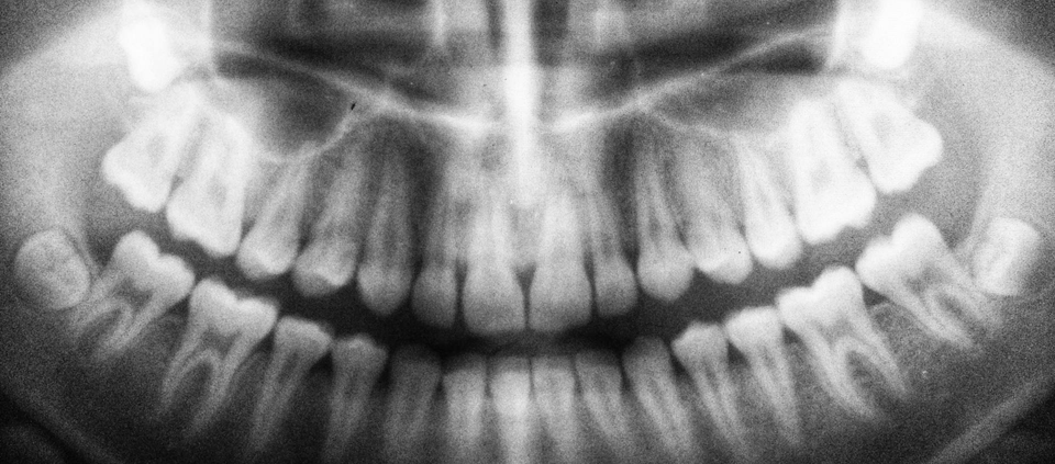 digital x-rays