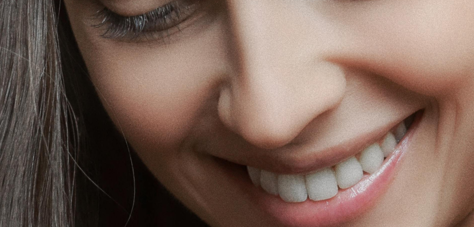 Snap-On Smile