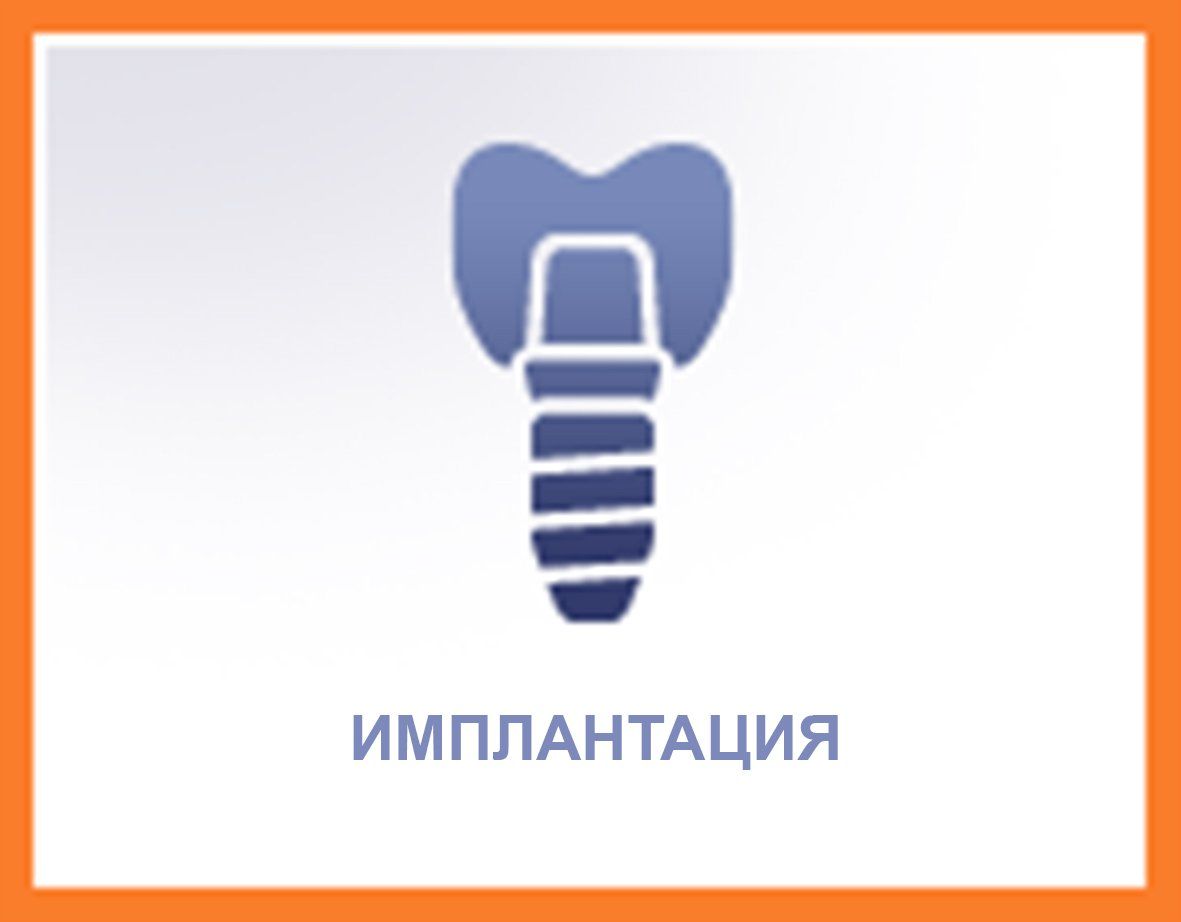 Синяя иконка зубного имплантата с русским текстом «ИМПЛАНТАЦИЯ» на белом фоне с оранжевой рамкой.