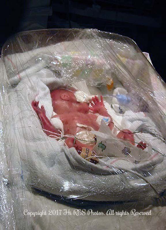 A baby is laying in a incubator in hospital 