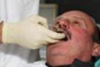 Crowns and Bridges — Dentals Services in Orland Park, Illinois Crowns and Bridges — Dentals Services in Orland Park, Illinois