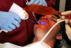 Sealants — Dentals Services in Orland Park, Illinois Sealants — Dentals Services in Orland Park, Illinois