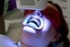 Teeth Whitening — Dentals Services in Orland Park, Illinois Teeth Whitening — Dentals Services in Orland Park, Illinois
