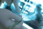 Teeth Examination — Dentals Services in Orland Park, Illinois Teeth Examination — Dentals Services in Orland Park, Illinois