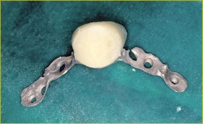 denti