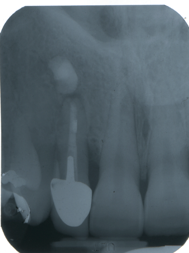 denti