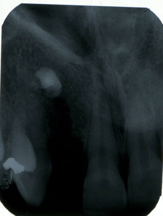 denti