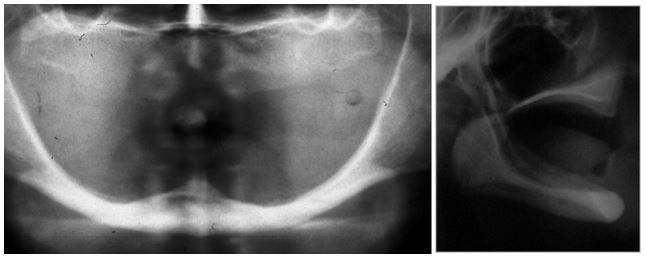 radiografia denti