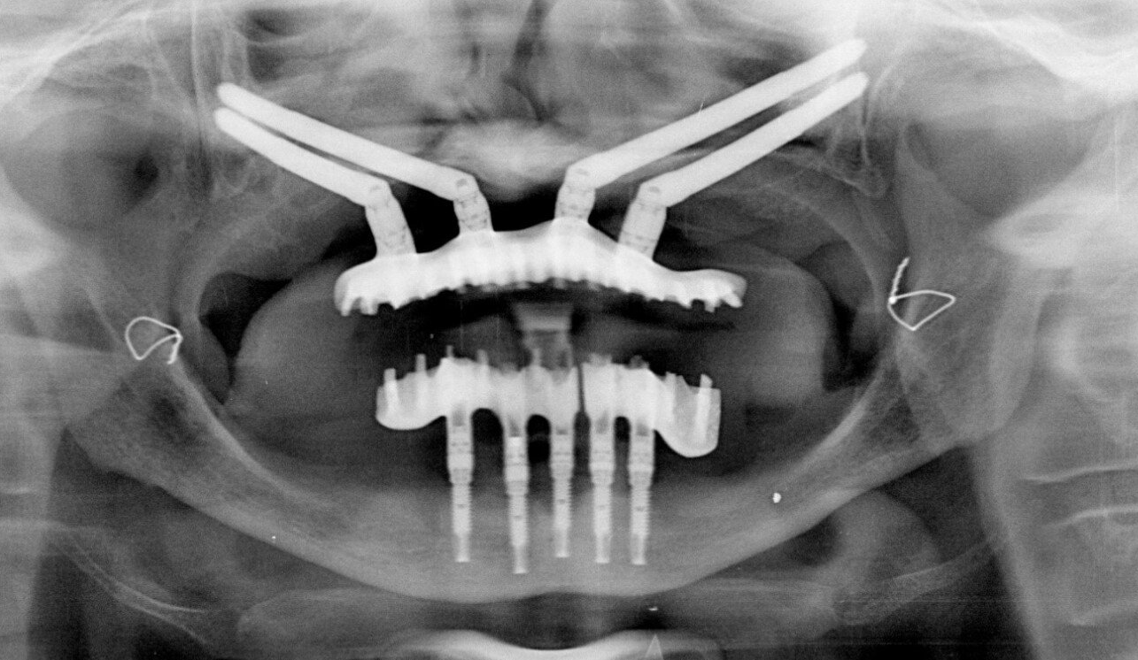 radiografia