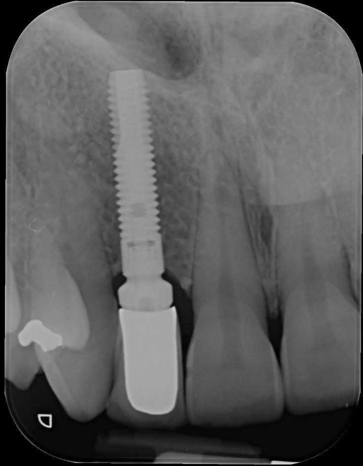 denti