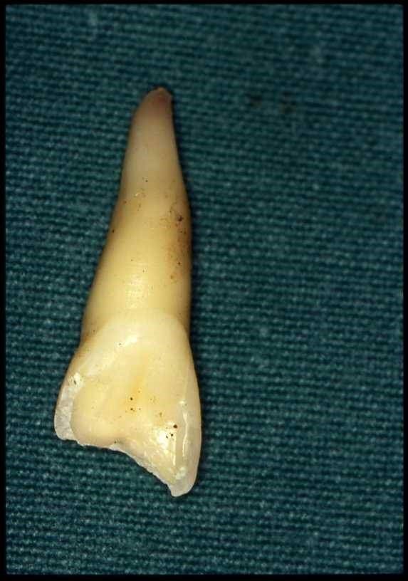 denti