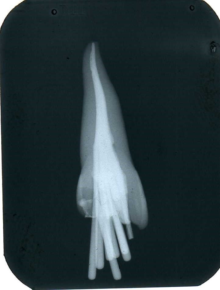 denti
