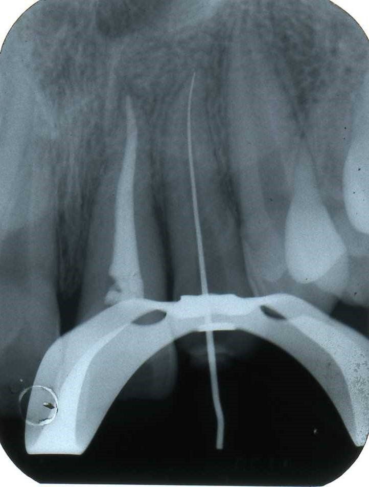 denti