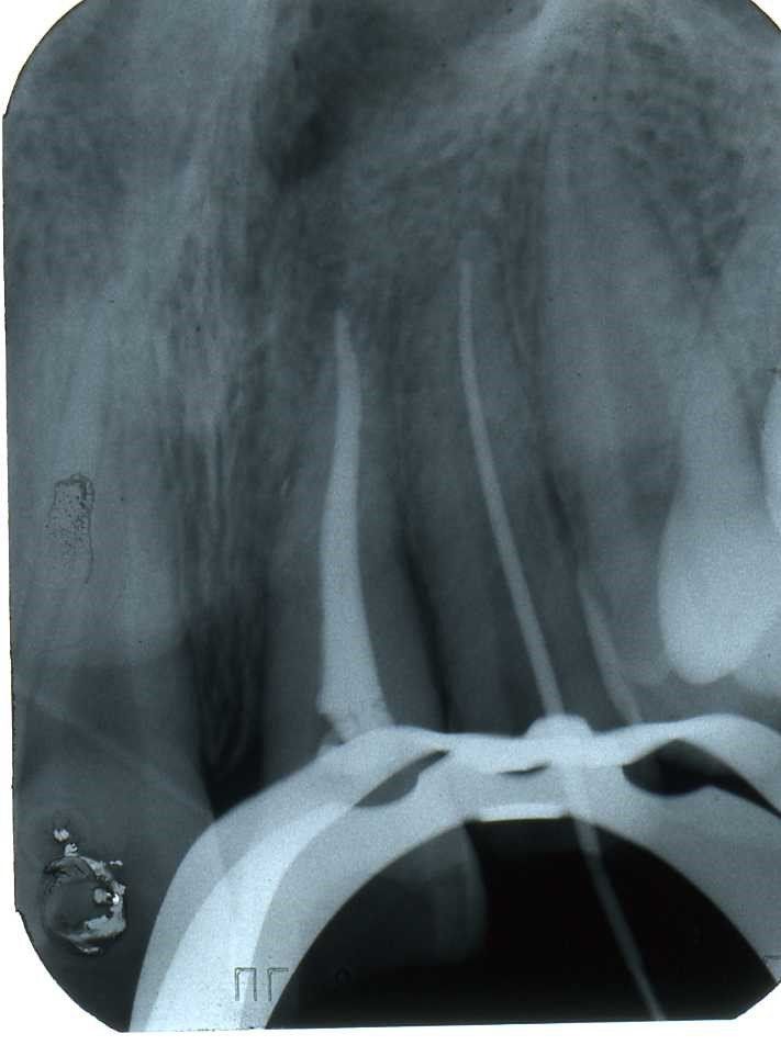 denti