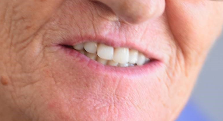 sorriso
