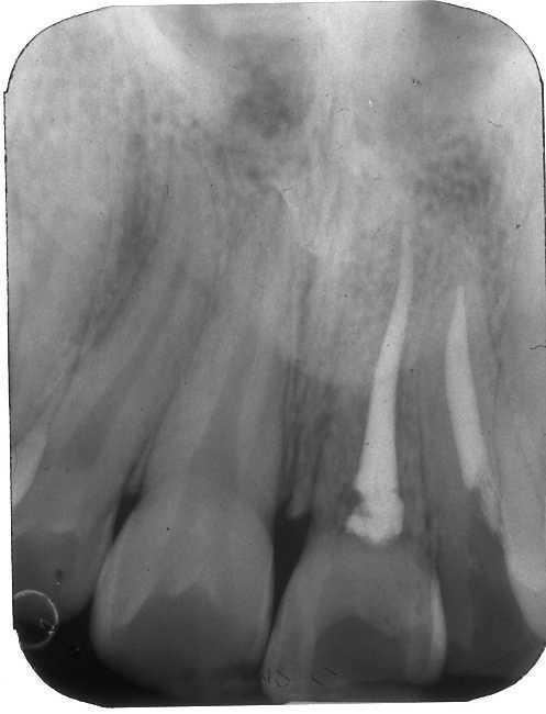 denti