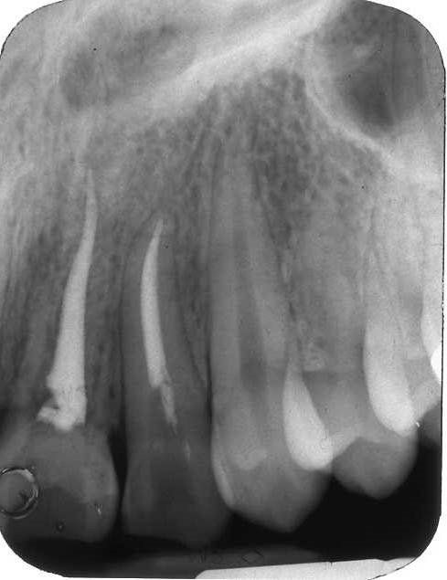 denti