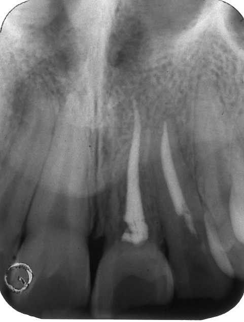 denti