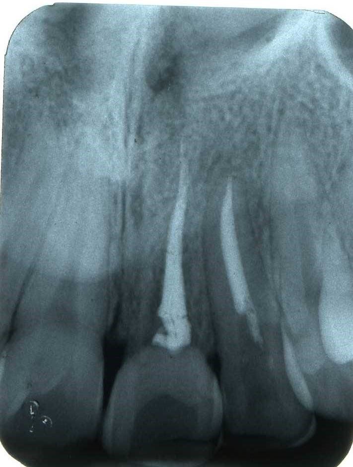 denti