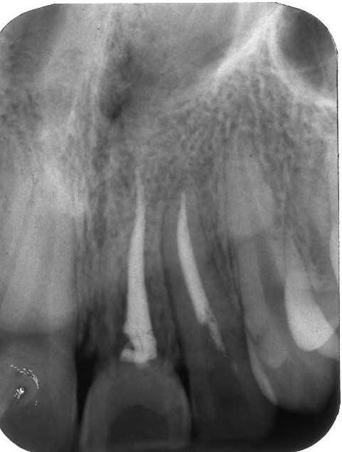denti