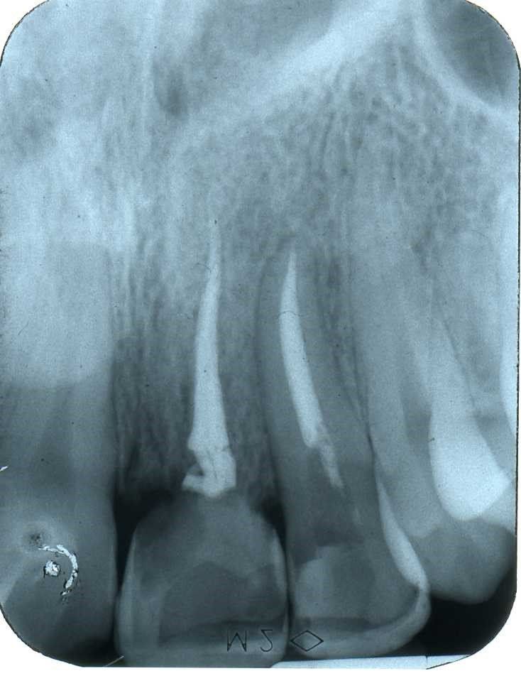 denti