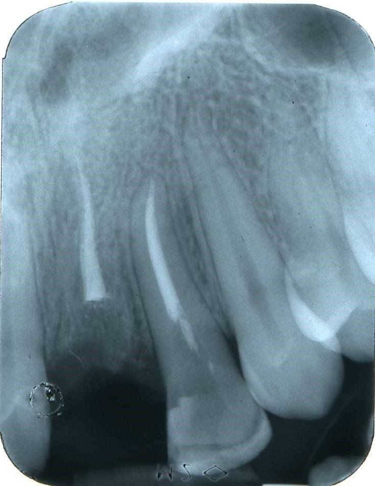 denti