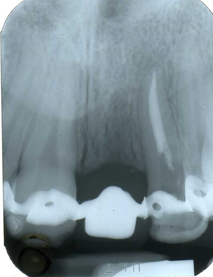 denti