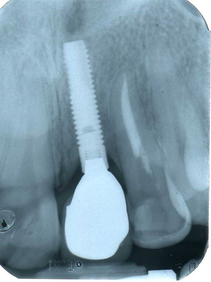 denti