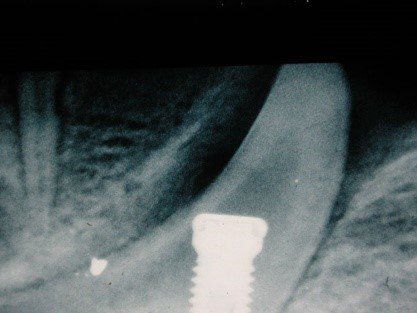 denti