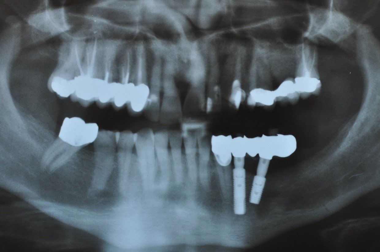 denti