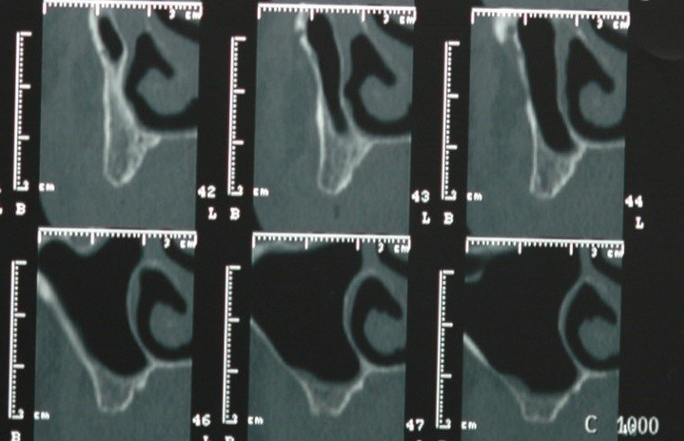 radiografia