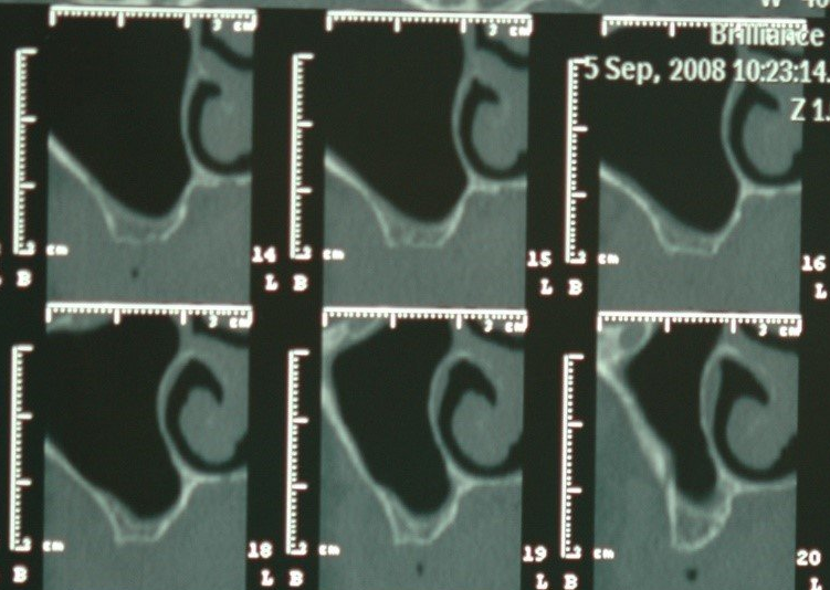 radiografia