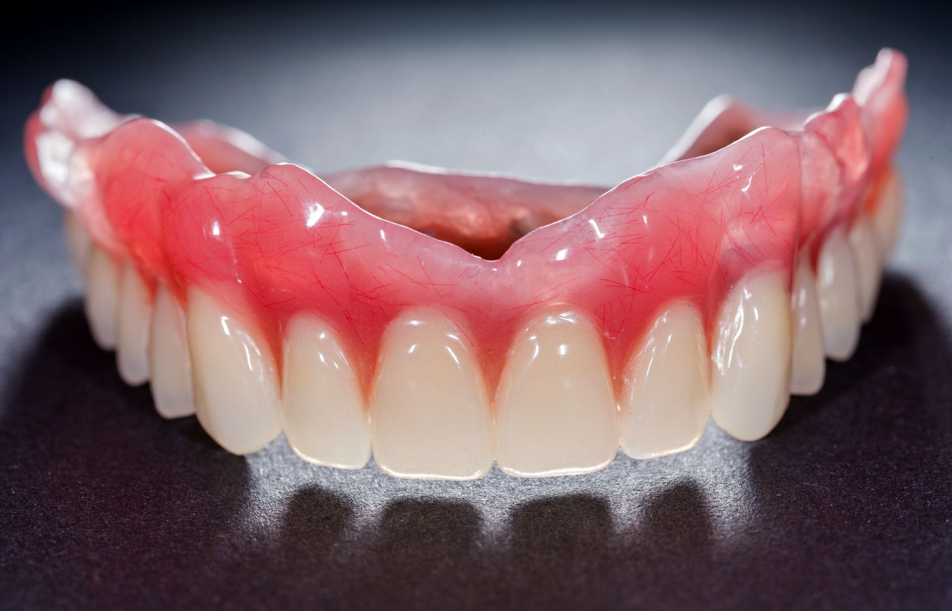 impianti dentali