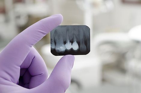 Gum Infection — Teeth X-Ray in Mansfield, OH Gum Infection — Teeth X-Ray in Mansfield, OH