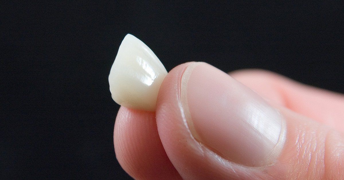 porcelain crowns, dental crowns
