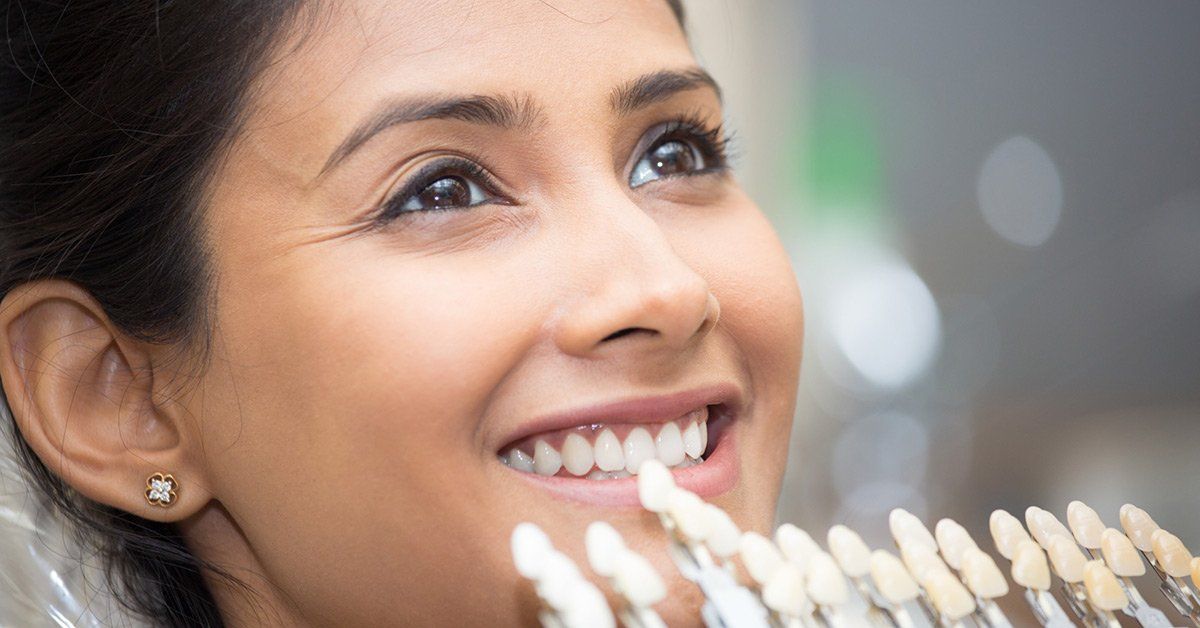 dental veneers
