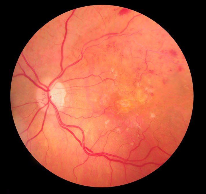 A close up of a person 's eye with a black background