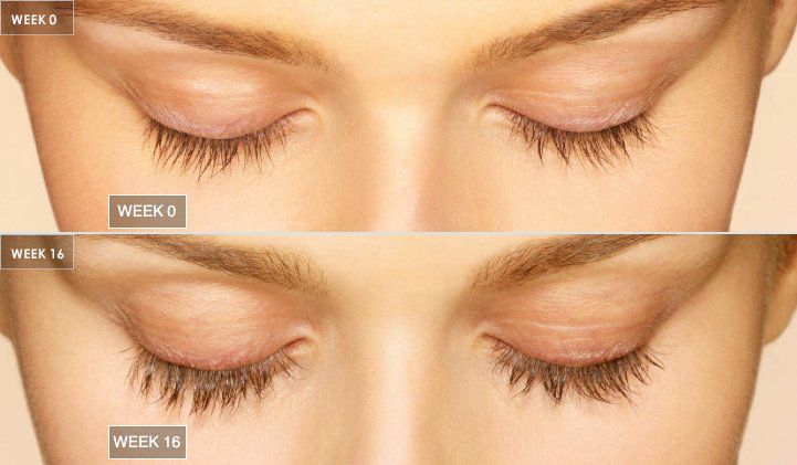 A before and after picture of a woman 's eyelashes after 16 weeks of Latisse
