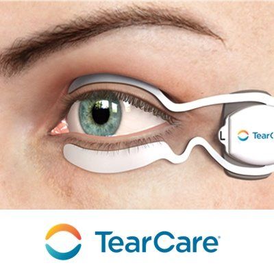 Patient receiving treatment for dry eyes with TearCare device