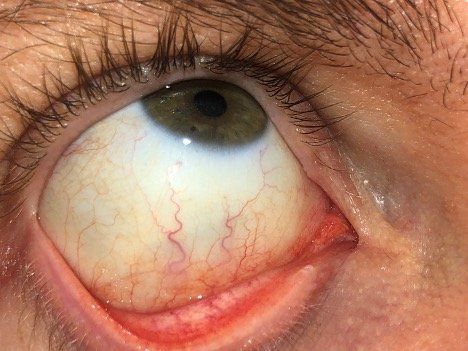 A close up of a person 's eye looking up