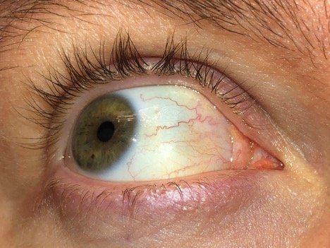 A close up of a person 's eye looking left